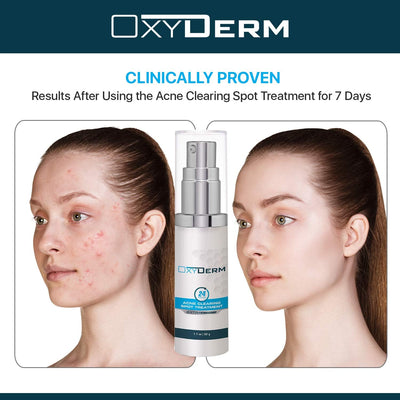Acne Spot Treatment- Overnight Pimple Treatment for All Skin Types without Over Drying your Skin. Removal for Inflamed Blackheads, Whiteheads, Cystic Acne. Results within Hours for Adults & Teens.